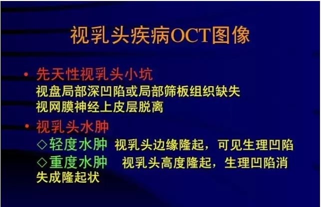 OCT���ۿ��ٴ�����е�Ӧ��