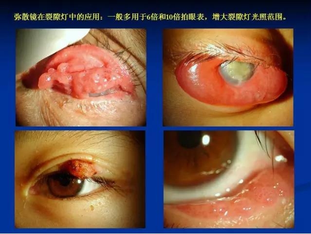 ��ǰ�������������