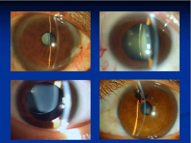 ��ǰ�������������