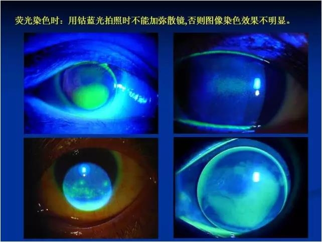 ��ǰ�������������