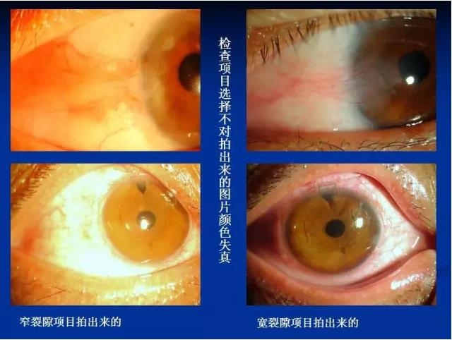 ��ǰ�������������