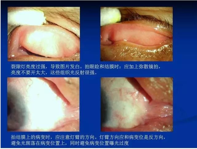 ��ǰ�������������