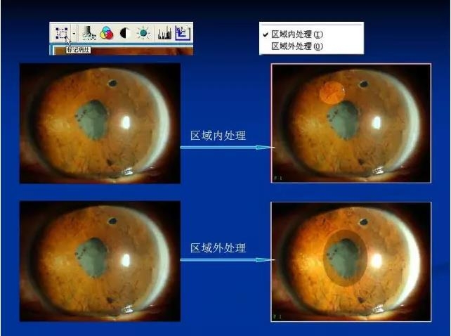 ��ǰ�������������