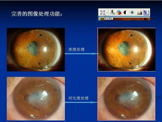 ��ǰ�������������