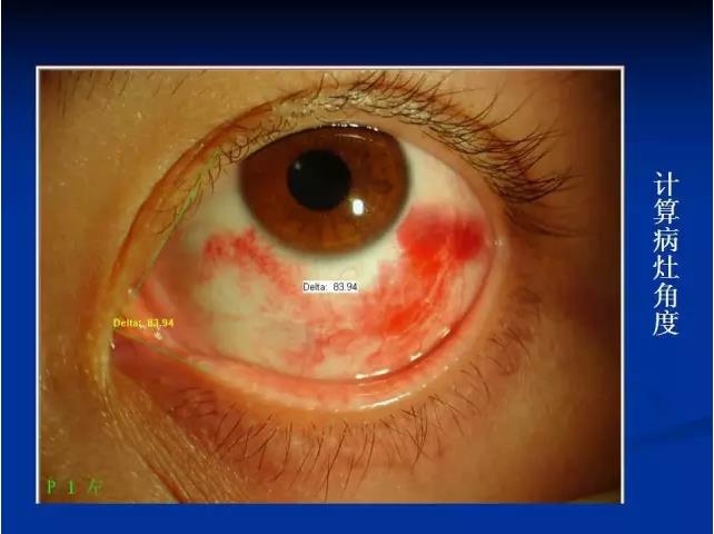 ��ǰ�������������