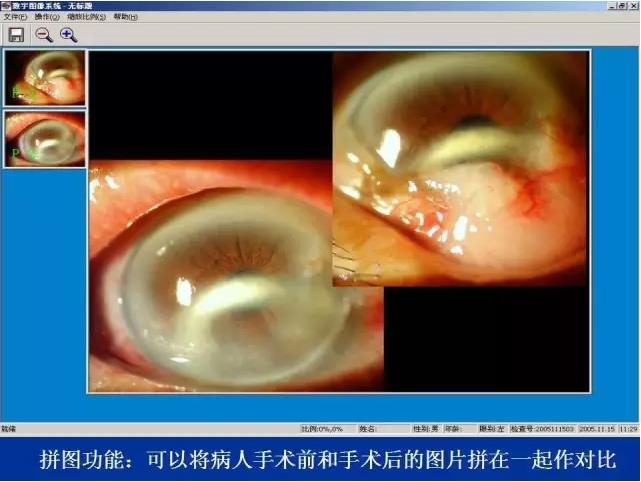 ��ǰ�������������