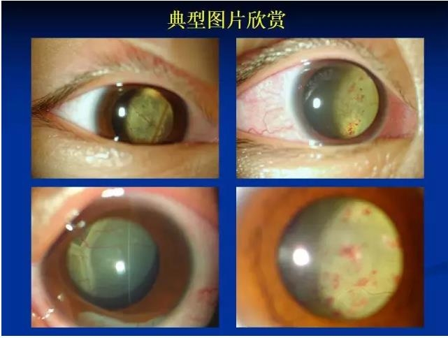 ��ǰ�������������