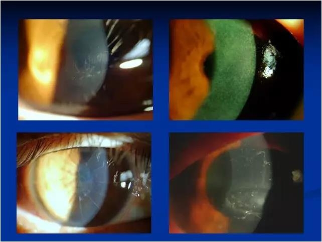 ��ǰ�������������