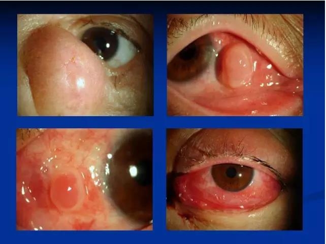 ��ǰ�������������