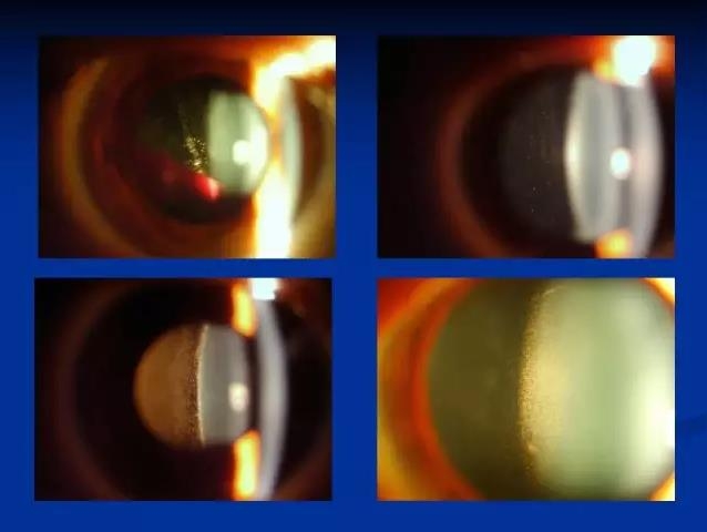 ��ǰ�������������