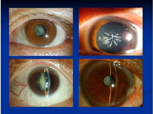 ��ǰ�������������