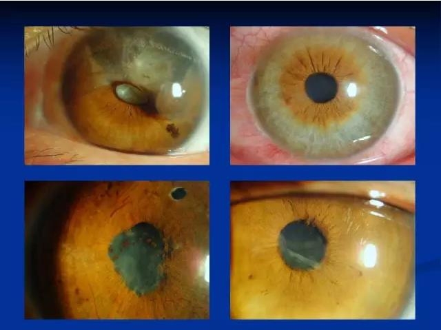 ��ǰ�������������