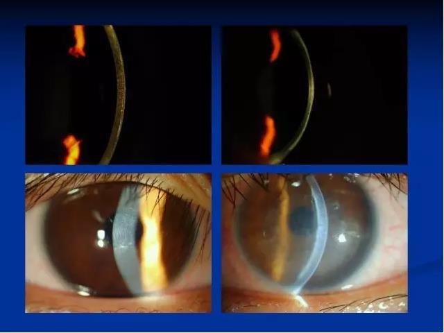 ��ǰ�������������