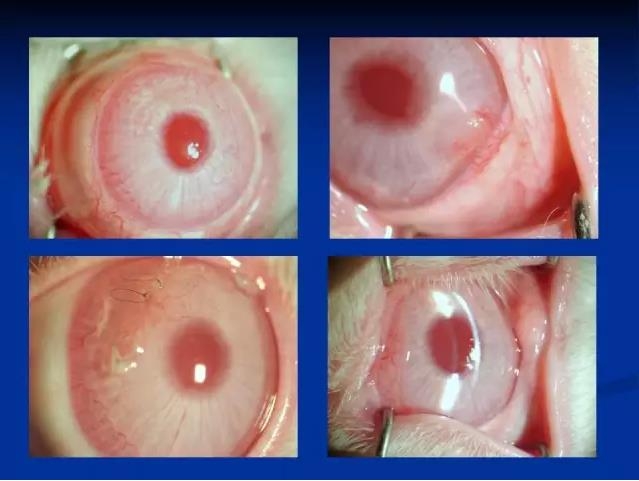 ��ǰ�������������