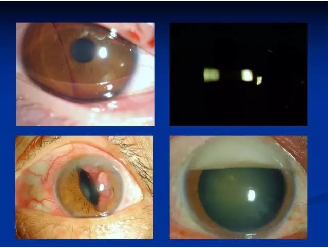 ��ǰ�������������