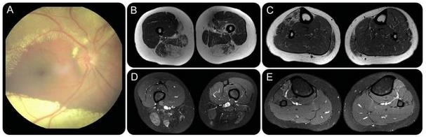 ��������1 ��������ͼ�Ӫ�������ɰ鷢�۲�����Ĥ��