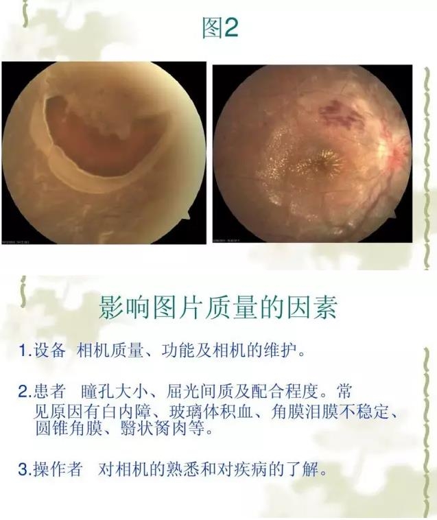 �����������������۵���Ƭ