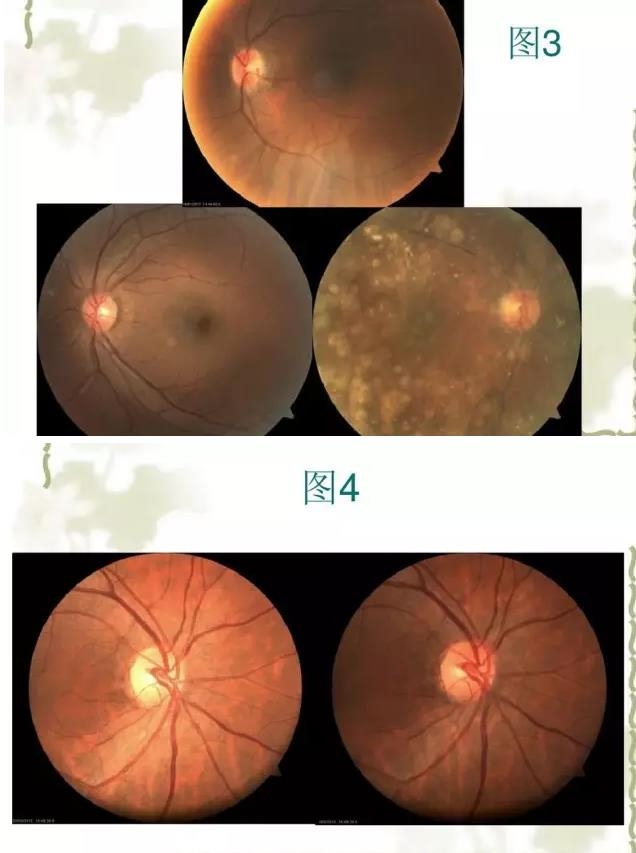 �����������������۵���Ƭ