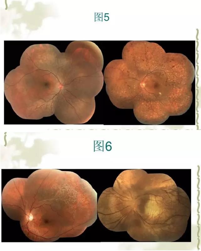 �����������������۵���Ƭ