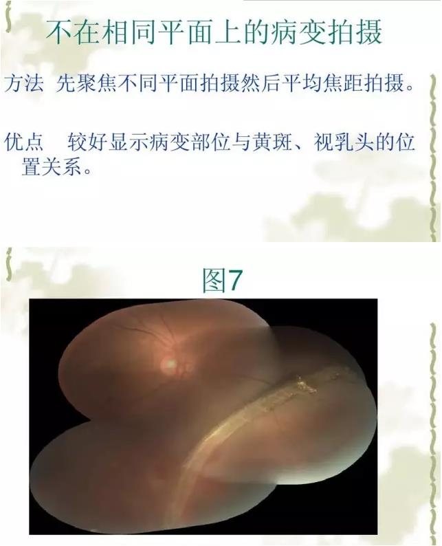 �����������������۵���Ƭ