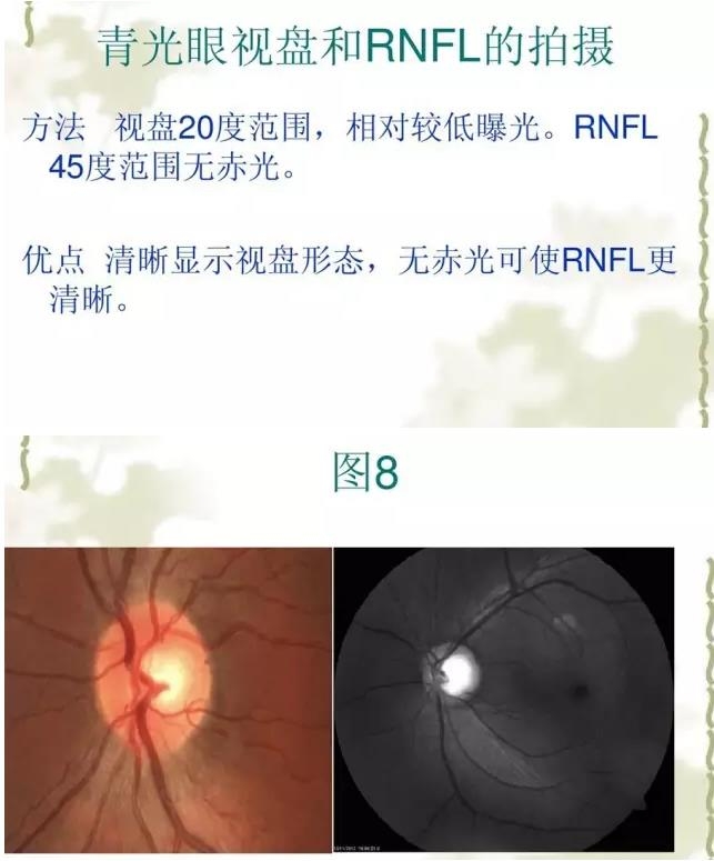 �����������������۵���Ƭ