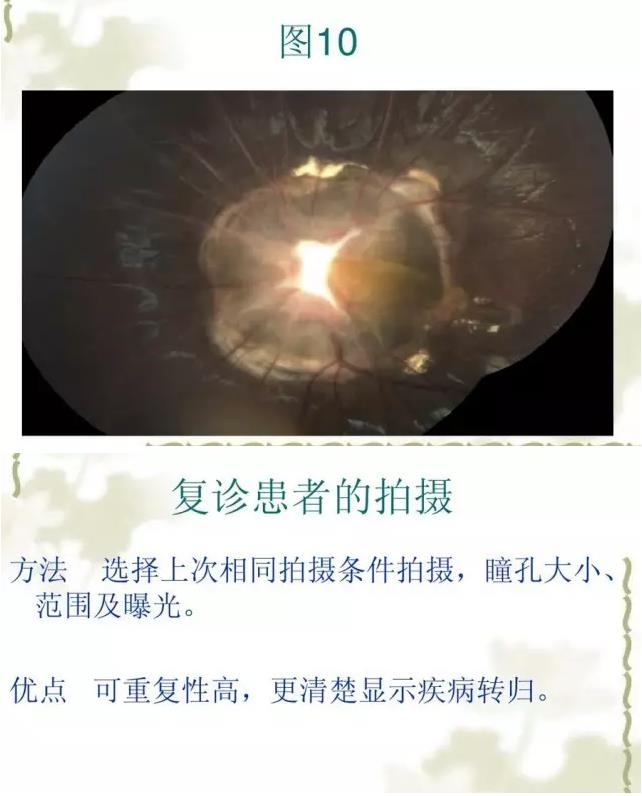 �����������������۵���Ƭ