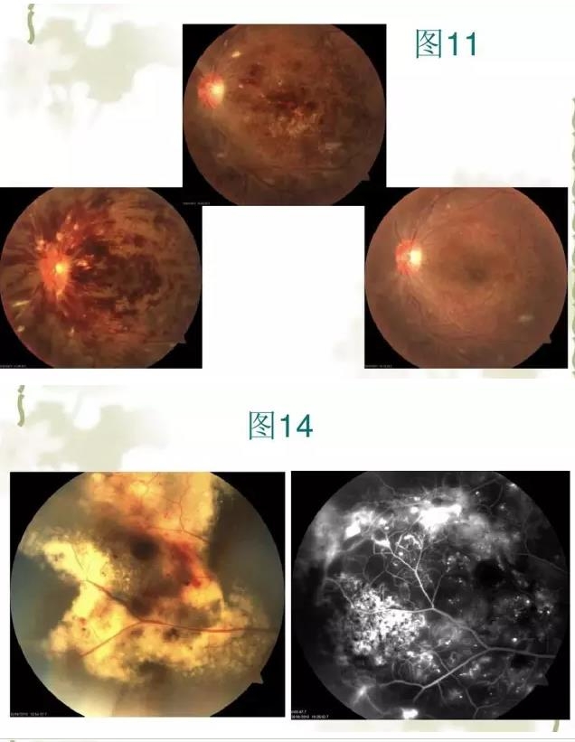 �����������������۵���Ƭ