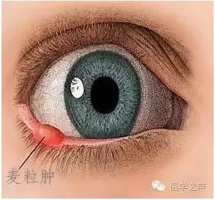 �����ȷ��ϡ��������� VS ������