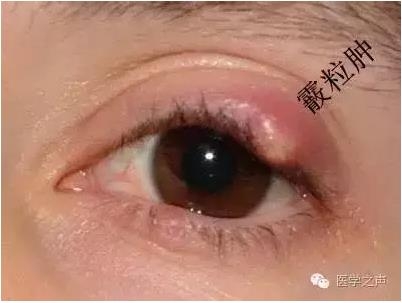 �����ȷ��ϡ��������� VS ������