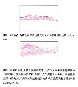 ������������״��ĤӪ������һ��