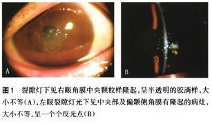 ������������״��ĤӪ������һ��