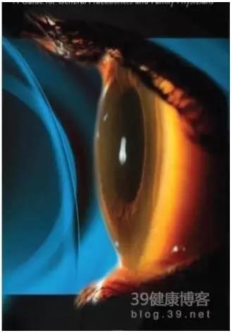 �۱���Ӧ���Խ�������