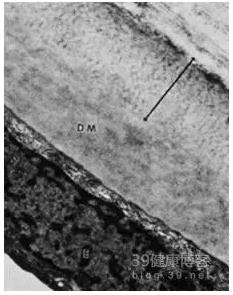 �۱���Ӧ���Խ�������