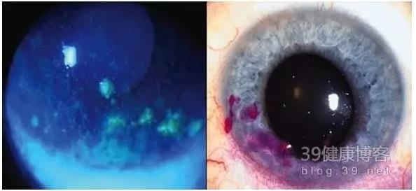 �۱���Ӧ���Խ�������