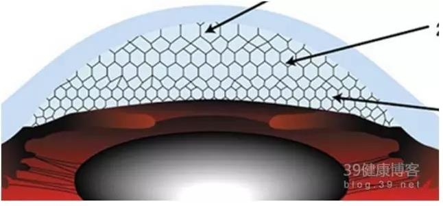 �۱���Ӧ���Խ�������