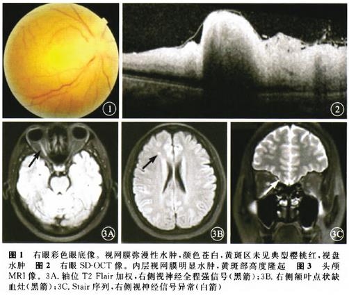 ��������ҽԴ�Լ����۶���˨��һ��