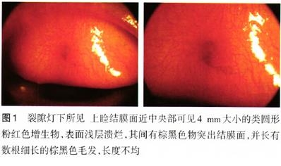 ������������Ĥ�»�̥��һ��