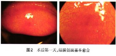 ������������Ĥ�»�̥��һ��