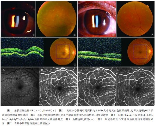 �����������������Ĥ��1��