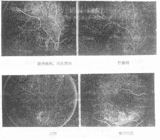 �۵�ӫ��Ѫ����Ӱ������������