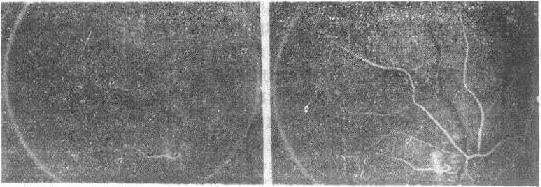 �۵�ӫ��Ѫ����Ӱ������������