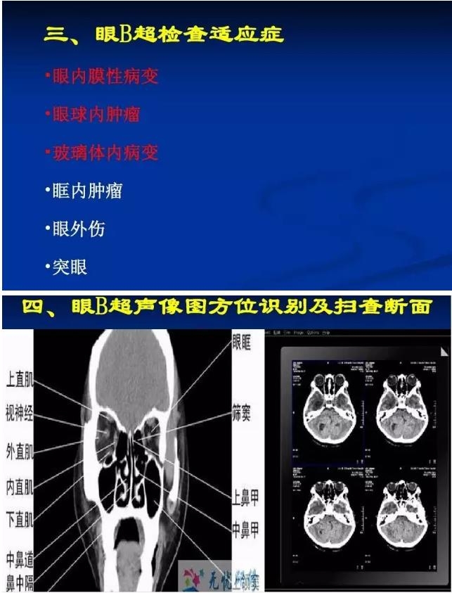 �۲�B����飨PPTͼ�İ棩