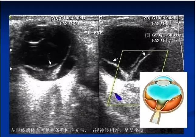 �۲�B����飨PPTͼ�İ棩