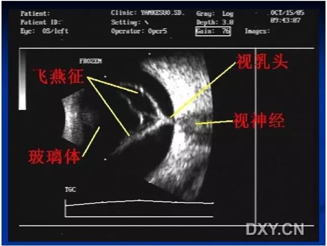 �۲�B����飨PPTͼ�İ棩