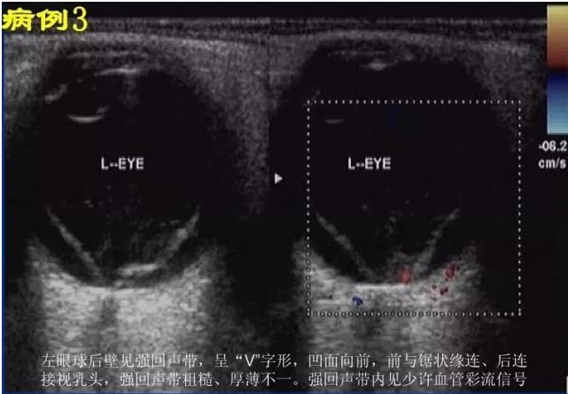 �۲�B����飨PPTͼ�İ棩