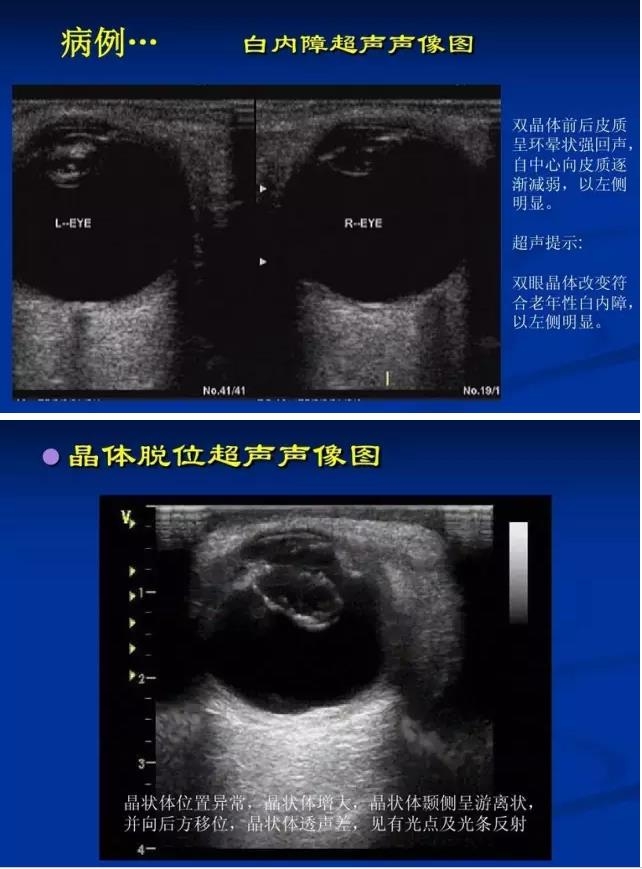 �۲�B����飨PPTͼ�İ棩