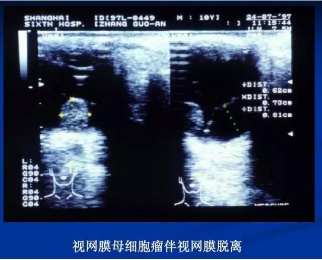 �۲�B����飨PPTͼ�İ棩