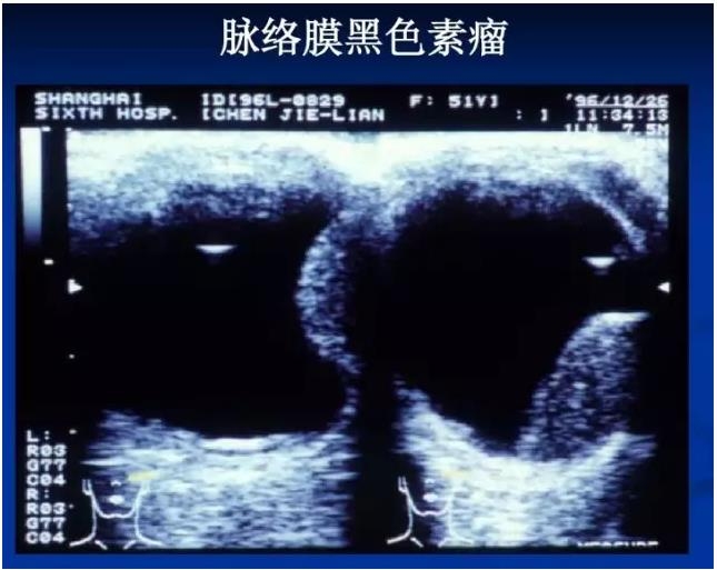 �۲�B����飨PPTͼ�İ棩