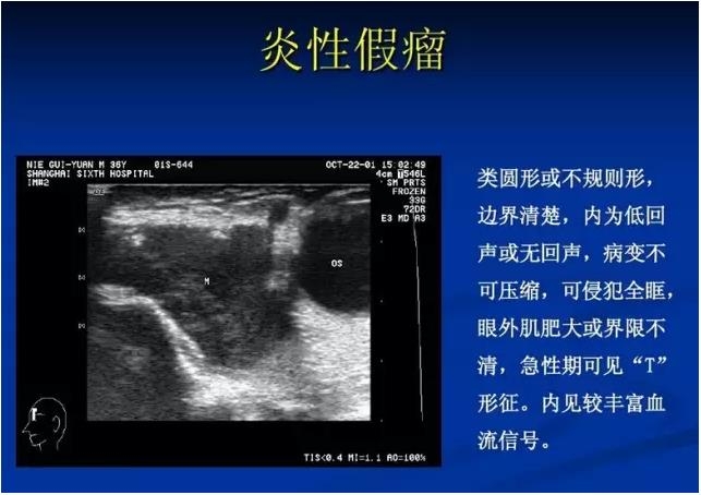 �۲�B����飨PPTͼ�İ棩