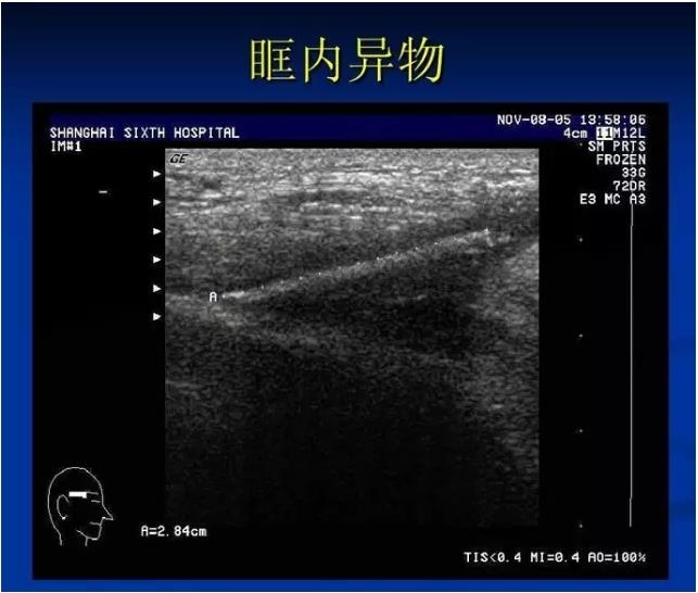 �۲�B����飨PPTͼ�İ棩